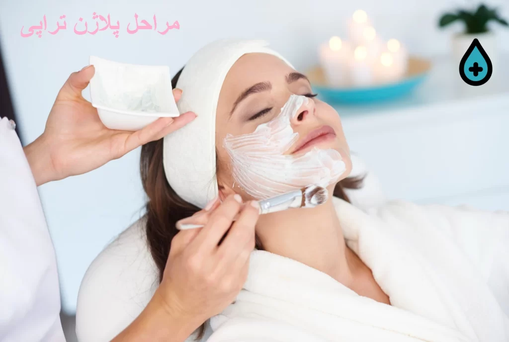 مراحل پلاژن تراپی