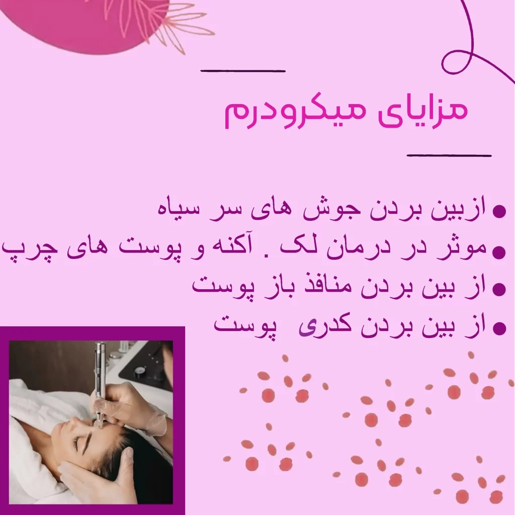 مزایای میکرودرم