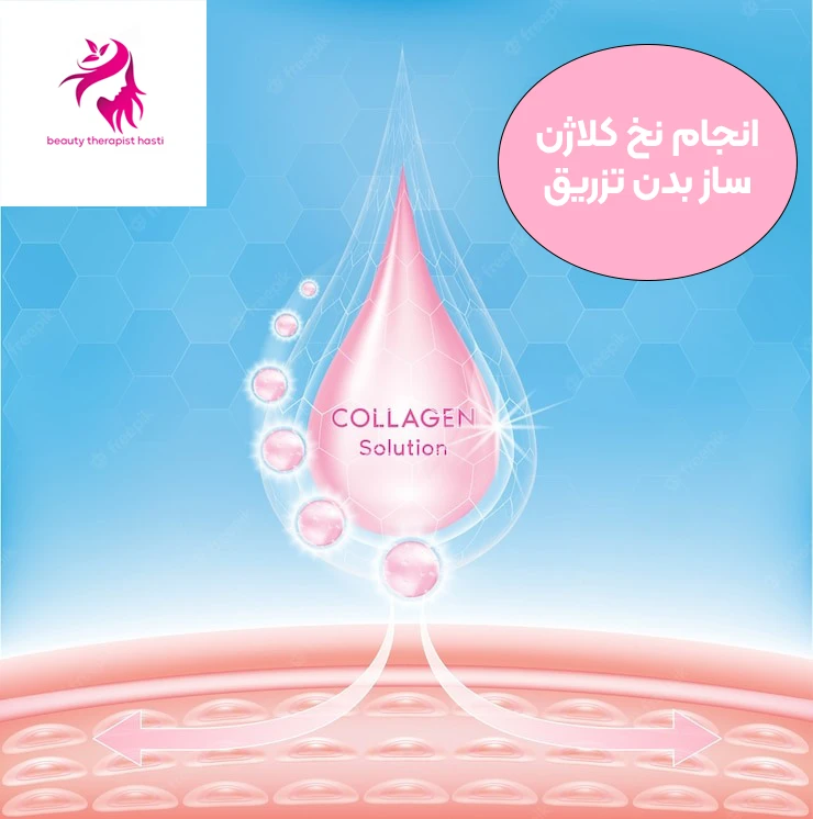نخ کلاژن ساز بدون تزریق