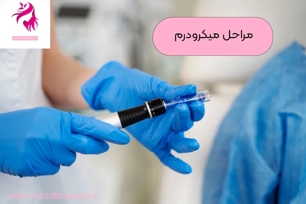 مراحل میکرودرم صورت